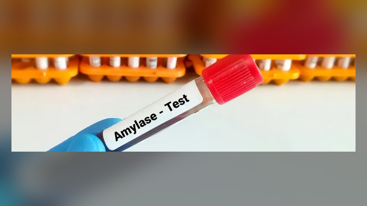 Analysis: Test